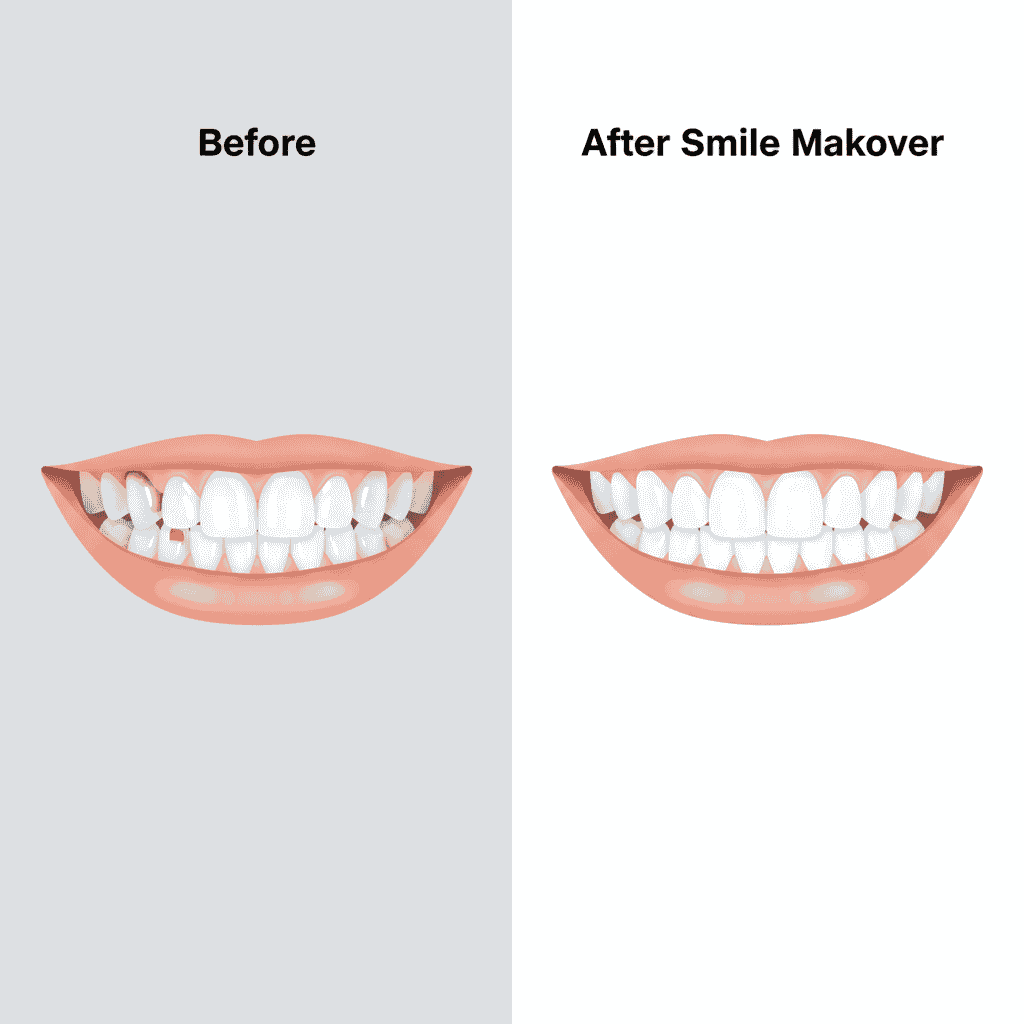 Smile Makeover