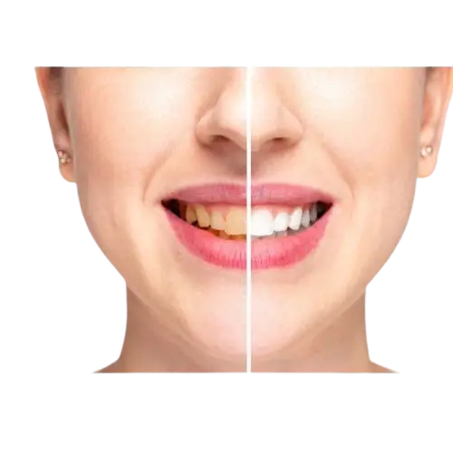 Teeth_Cleaning_Services General Dentistry