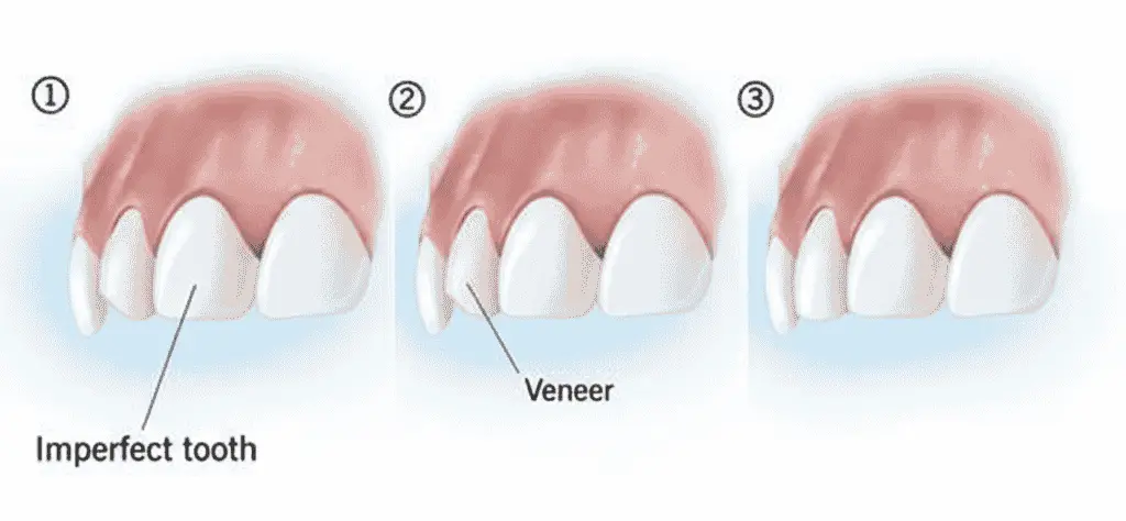 Venners Venners